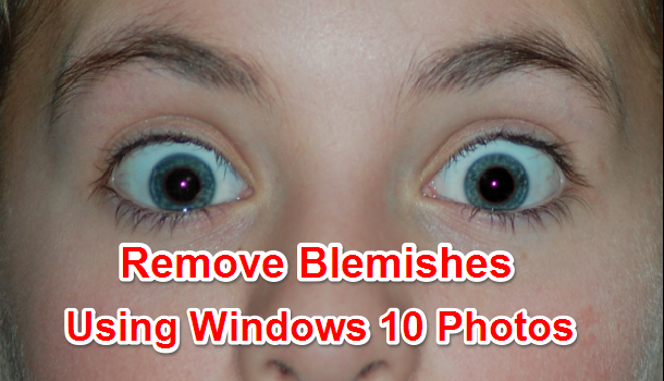 Remove Blemishes using Windows 10 Photos